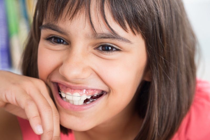 Moraga Orthodontist 27 retainer young girl 1 800