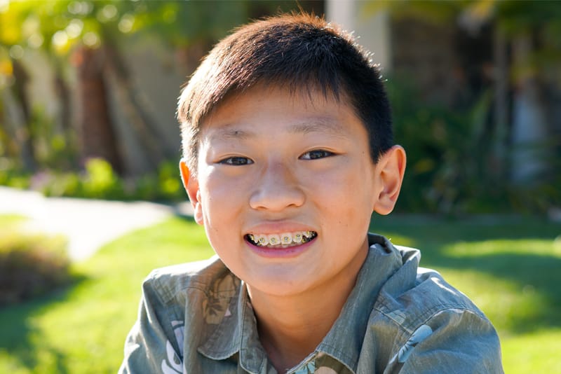 Moraga Orthodontist 24 young boy braces 800